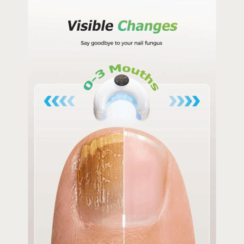 Lumora Beam (official Retailer) 2025